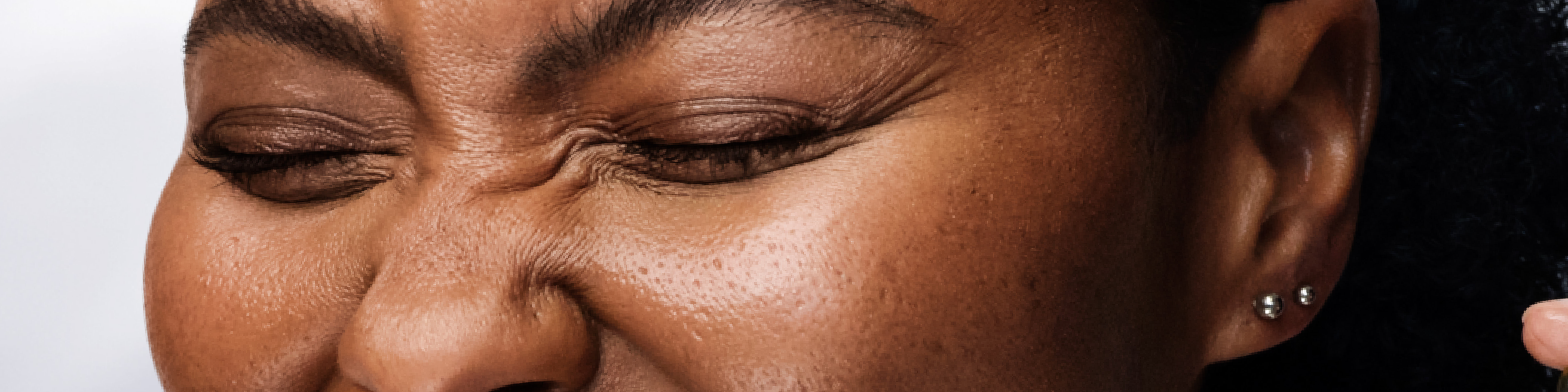  Why Premature Aging is Nothing to be Afraid Of